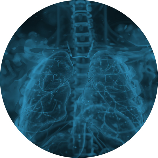 Le Terapie con Anestetici Locali nelle malattie respiratorie (asma, infezioni respiratorie e Sindrome da Distress Respiratorio Acuto)